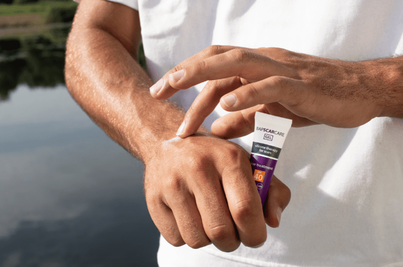 Littekenverzorging én zonbescherming in één – BAPSCARCARE Siliconengel met UV-bescherming