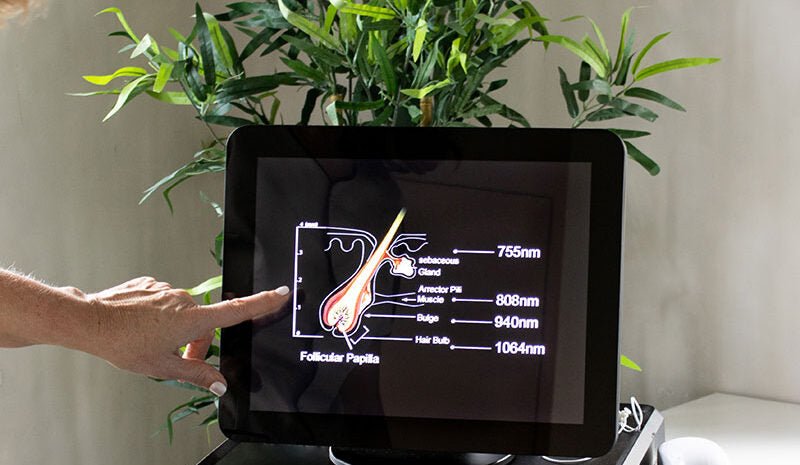 DIODE ICE 4-WAVE MASTER (QUATTRO-PRO) IPL - Ontharingslaser