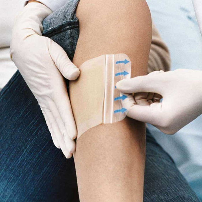 Hydrocoll - zelfklevend hydrocolloïdverband