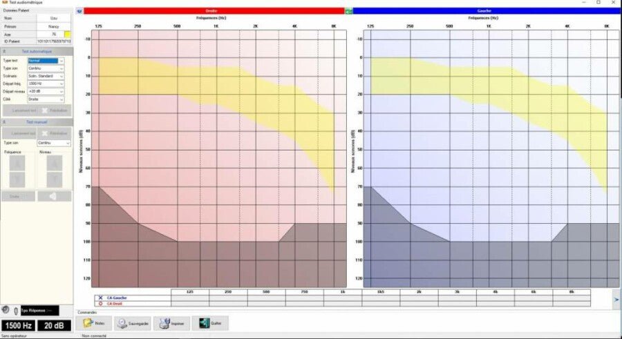 PC Screening Audiometer 600M – Professioneel gehoortest apparaat. Betrouwbare gehoortesten voor medische professionals