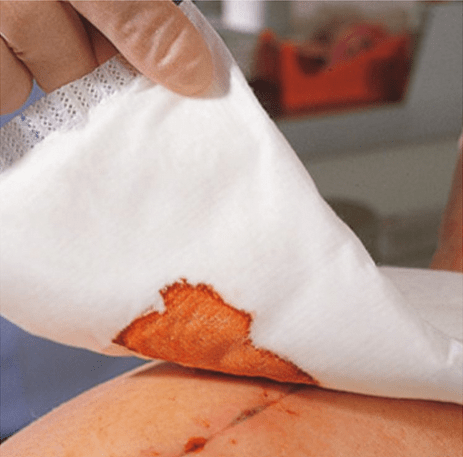 Zetuvit - steriel - absorberend verband