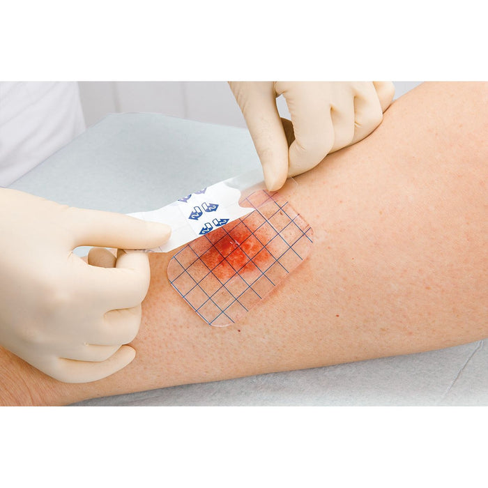 Hartmann Hydrotac Transparant Comfort gelverband