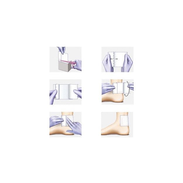 Hartmann Omnifix elastic fixatieverband